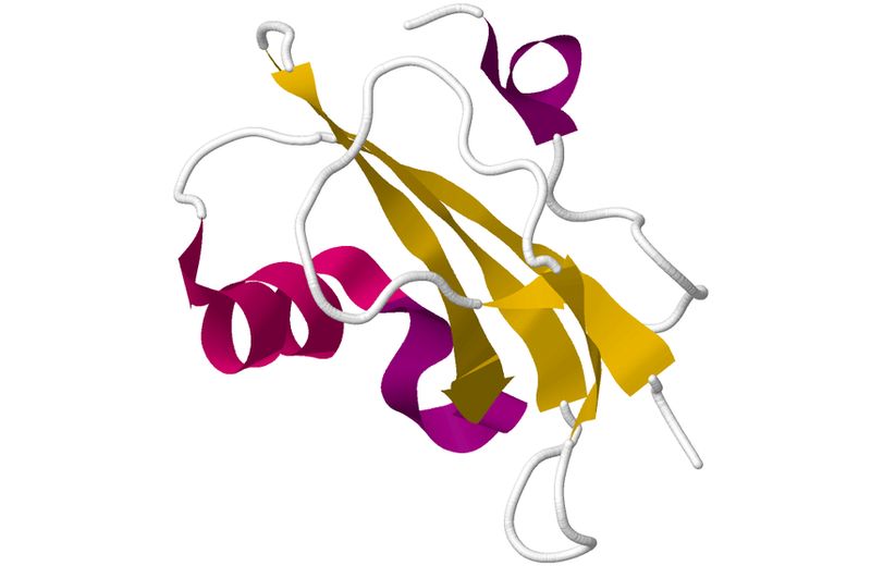 paroxysmal nocturnal hemoglobinuria (PNH)