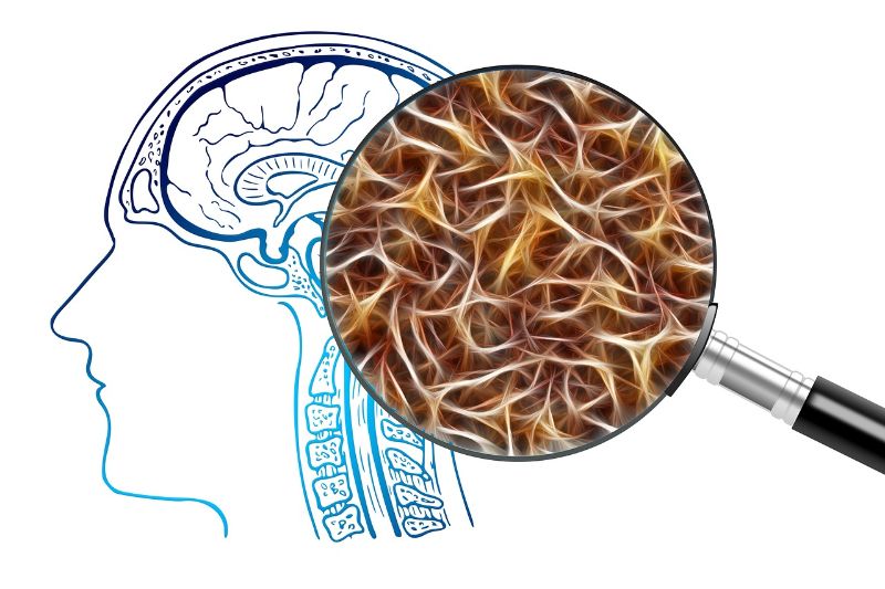 Alzheimer's Disease