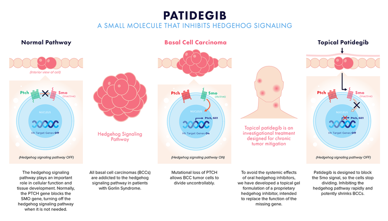 Patidegib
