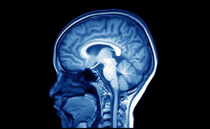 Alzheimer’s Disease