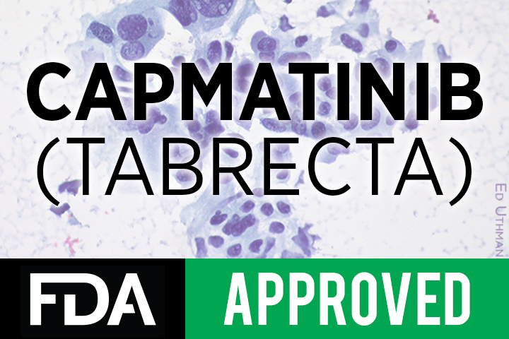 Tabrecta (capmatinib)