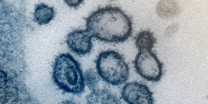 coronavirus-covid-19