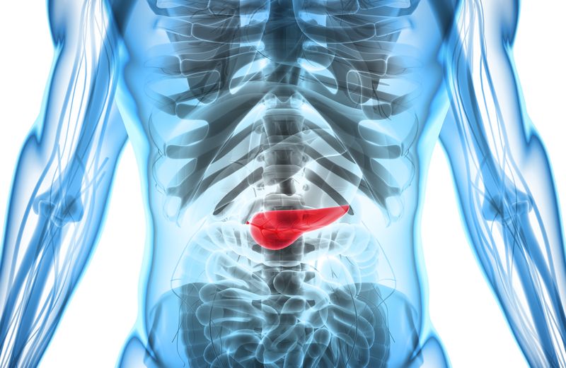 Pancreatic Cancer
