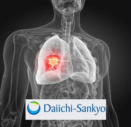 HERTHENA-Lung01 Phase 2 Study of Daiichi Sankyo’s Patritumab Deruxtecan Initiated in Patients with EGFR-Mutated NSCL