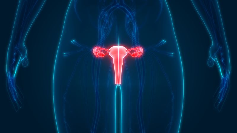 Ovarian Cancer