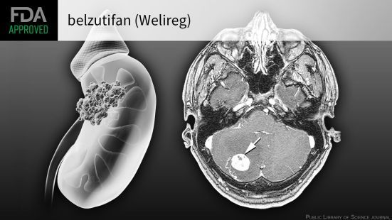 Welireg (belzutifan)
