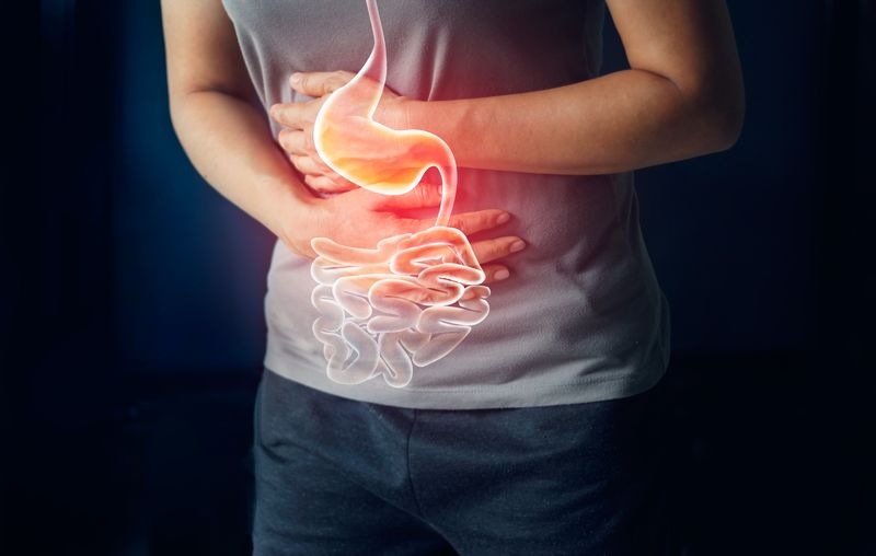 Ulcerative Colitis