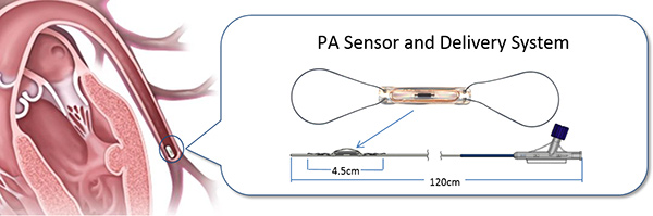 CardioMEMSDevice