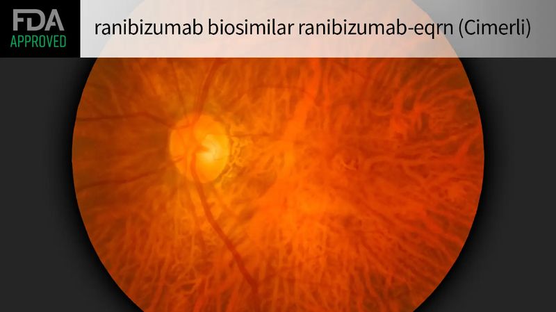 Cimerli (ranibizumab-eqrn)