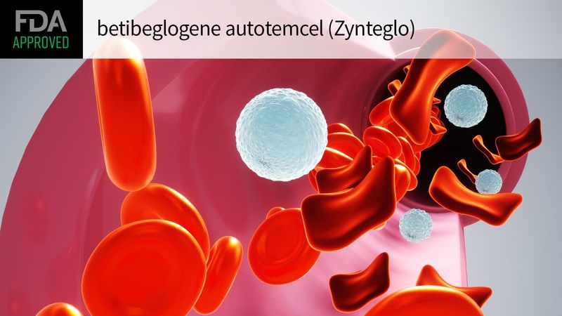 Zynteglo (betibeglogene autotemcel)