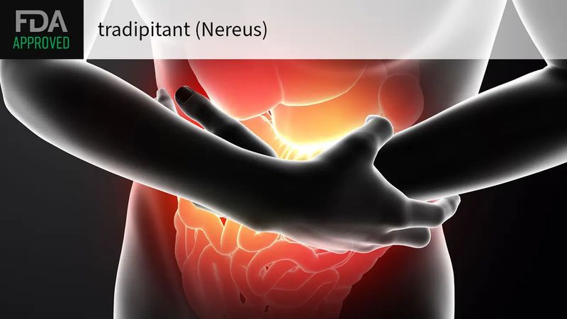 Nereus (tradipitant) Nereus (tradipitant)