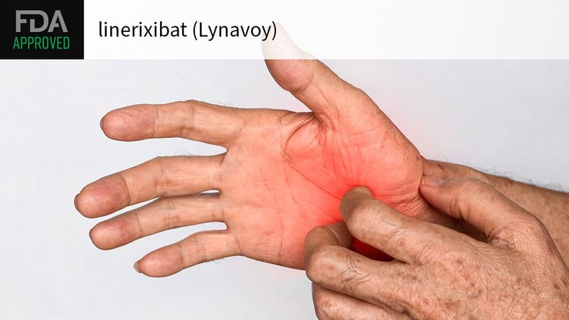 Lynavoy (linerixibat) Lynavoy (linerixibat)